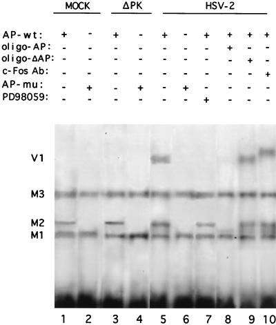 FIG. 11