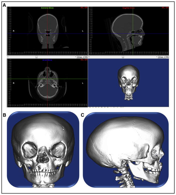 Fig 1