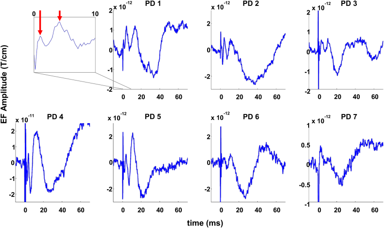 Fig. 4