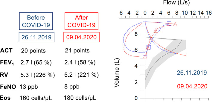 FIGURE 1