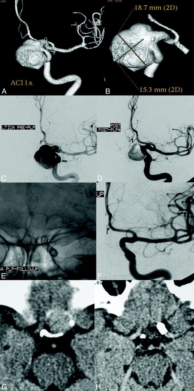 Fig 3.