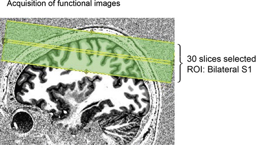 Fig. 2