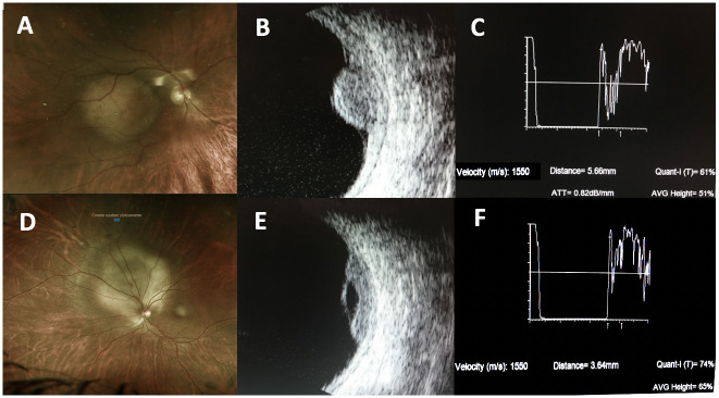 Fig 4