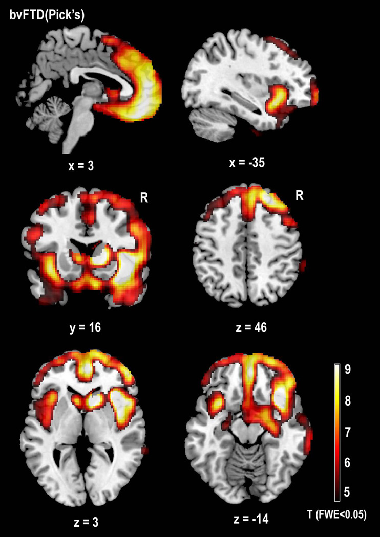 FIGURE 3