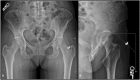 Fig. 1 A-B