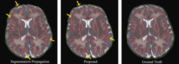 Figure 15