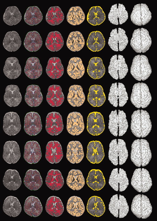 Figure 11