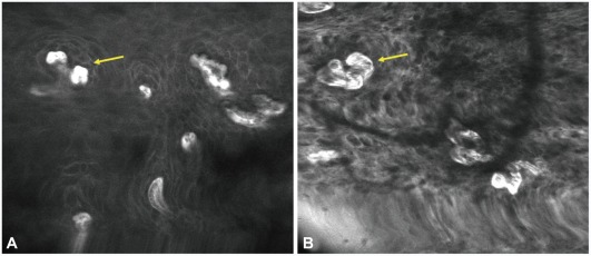 Fig. 10