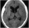 Fig. 9