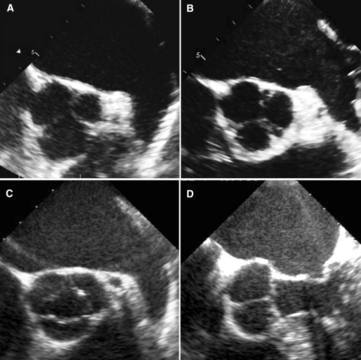 Fig. 1