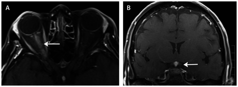 Figure 2-7.