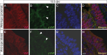 Figure 1—figure supplement 2.