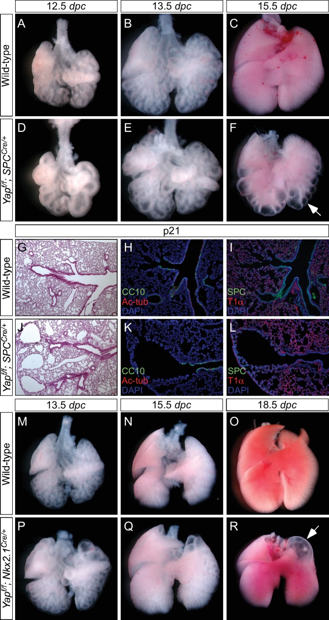 Figure 3—figure supplement 4.