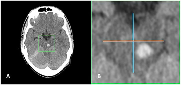 Fig. 5