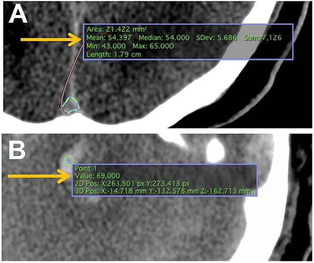 Fig. 3