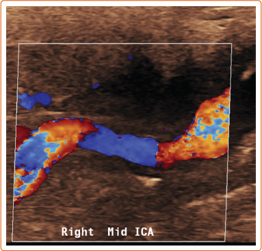 Figure 1: