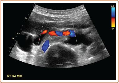 Figure 4: