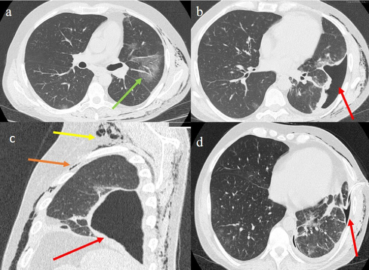 Fig 2