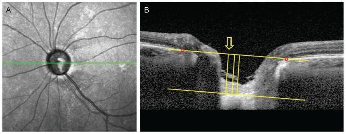 Fig. 1