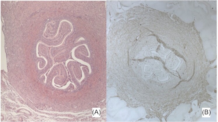 Fig. 10