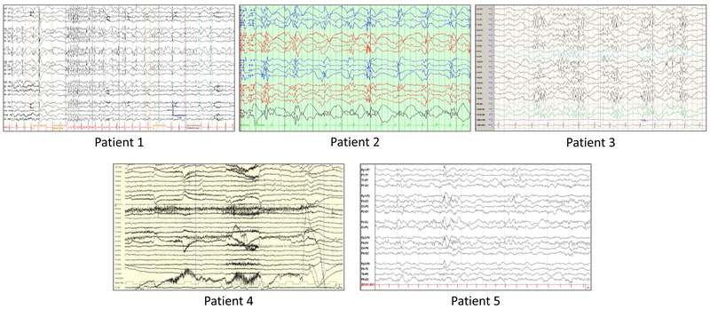 Figure 1: