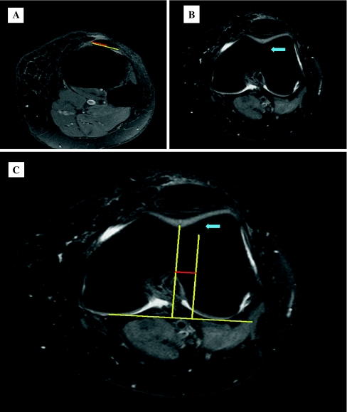 Fig. 1