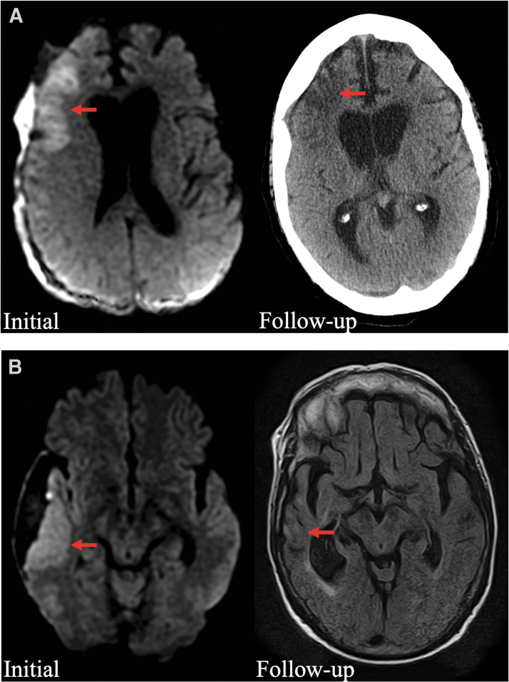 FIG. 3.