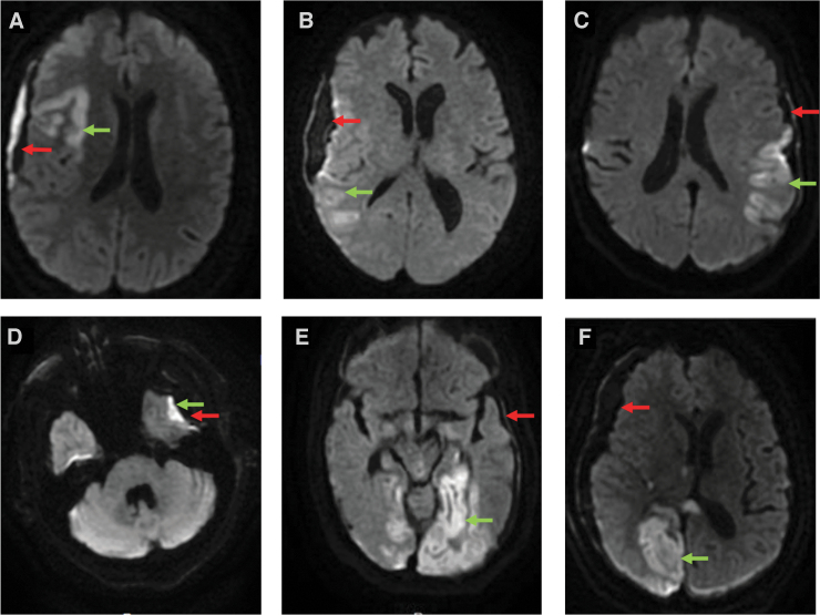 FIG. 2.