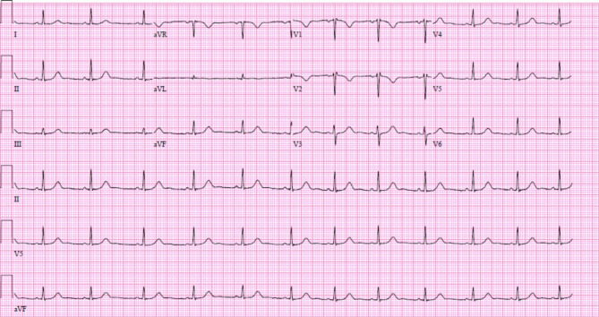 Fig. 2