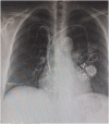 Fig. 2