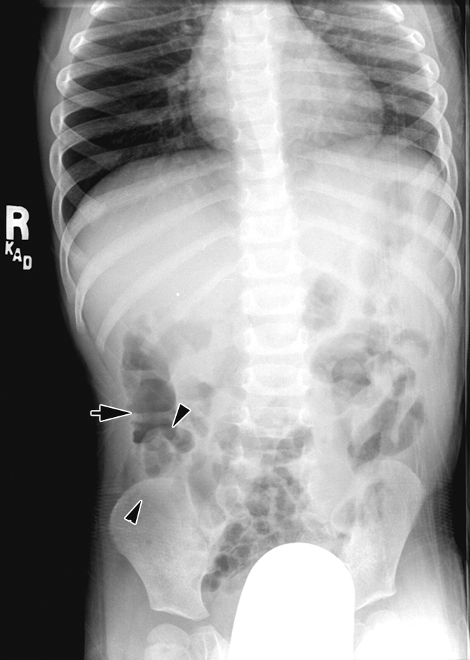 Figure 6b: