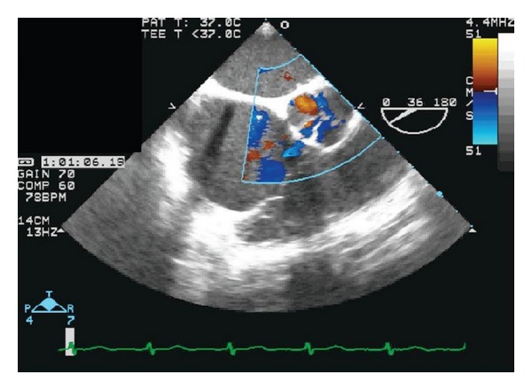 Figure 2