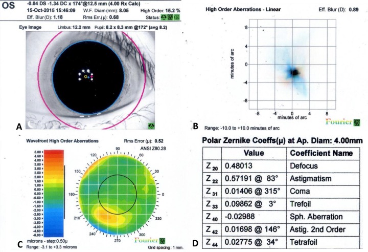 Fig 1