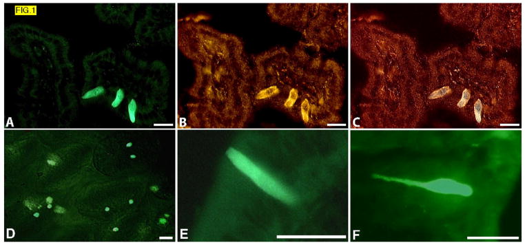 FIG. 1