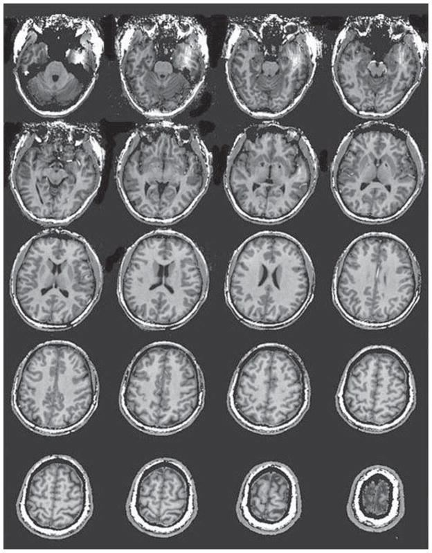 Fig. 10