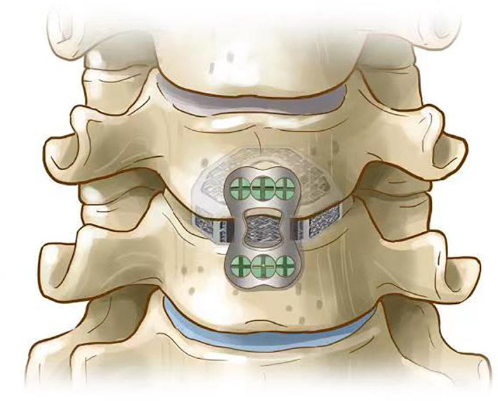 Fig. 4