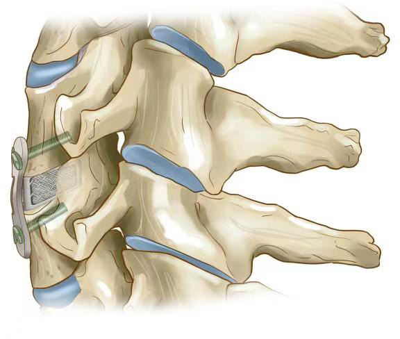 Fig. 5