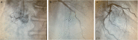 Fig 2.