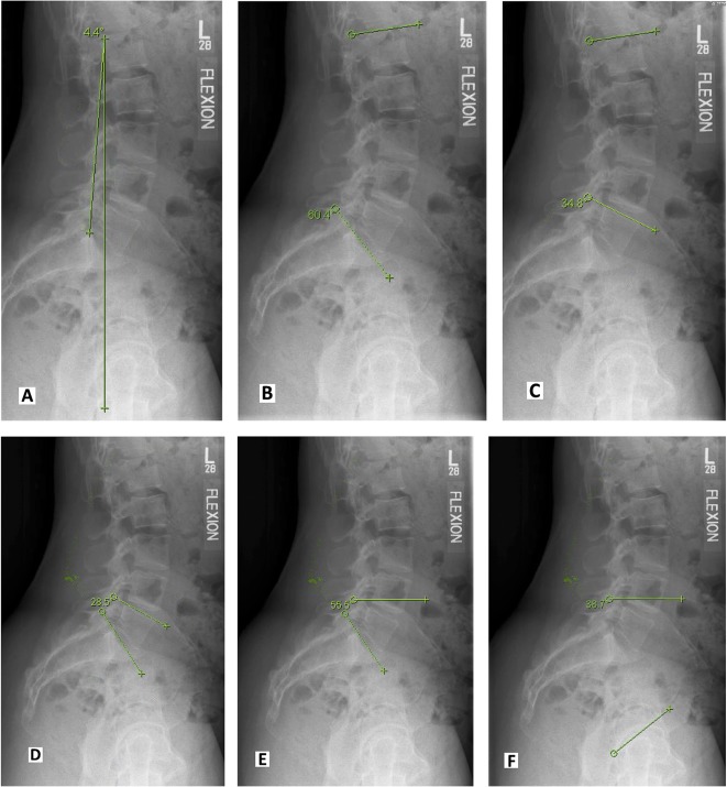 Fig. 1 A-F