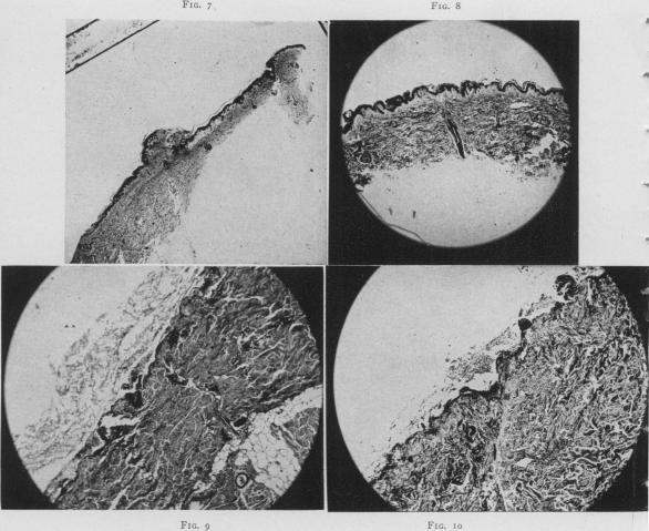 Fig. 7., Fig. 8., Fig. 9., Fig. 10.