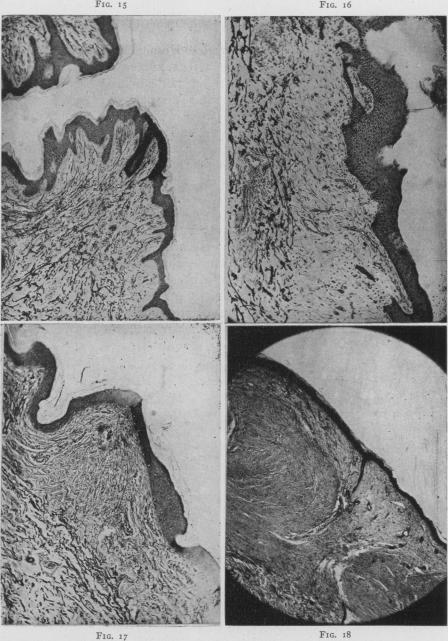 Fig. 15., Fig. 16., Fig. 17., Fig. 18.