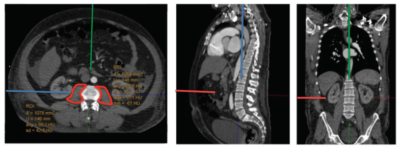 Figure 2