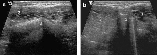 Fig. 13