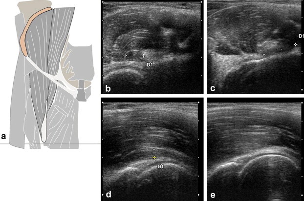 Fig. 15