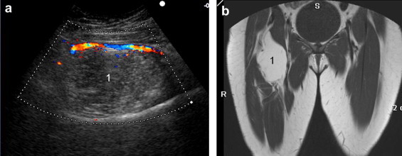 Fig. 18