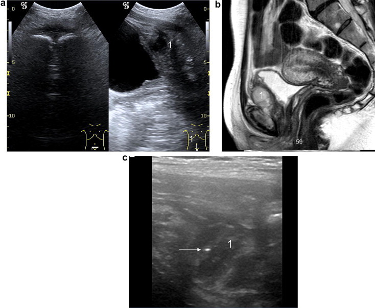 Fig. 7