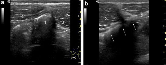 Fig. 14