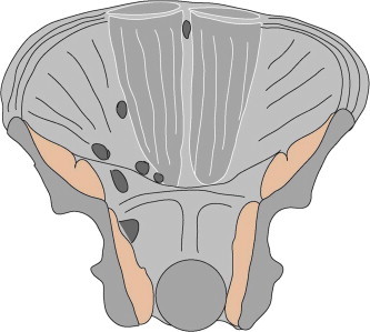 Fig. 11