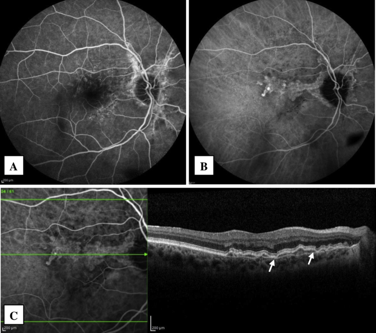 Fig. 1