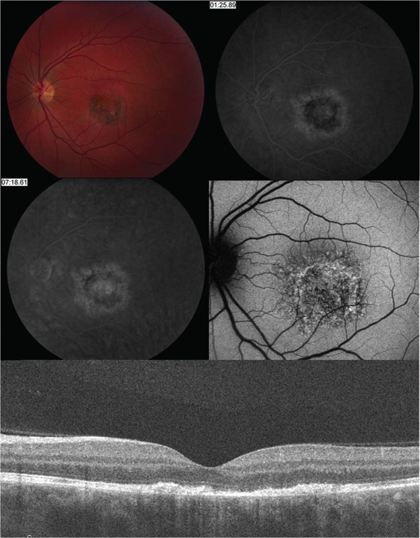 Figure 4